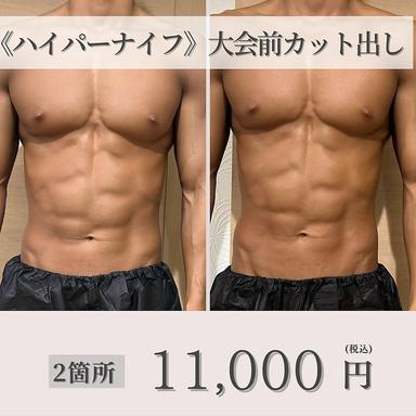 《ボディメイク・大会前に》オーダーメイドハイパーナイフカット出し 2箇所