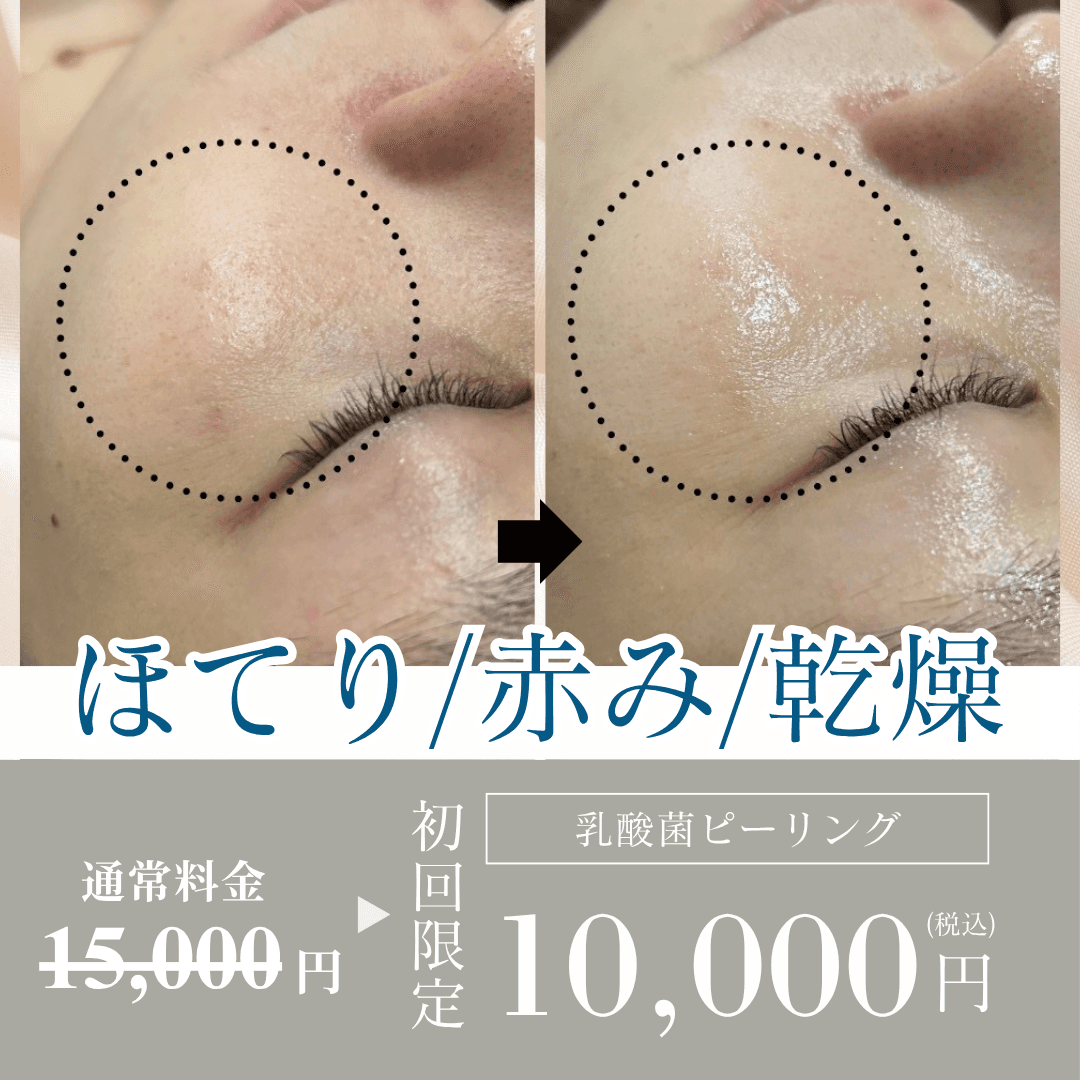 【初回お試し】ほてり/赤み/乾燥/夏の肌ストレスをリセット！乳酸菌ピーリング（デコルテ＋ヘッド付き）