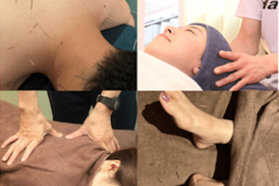 【頭痛/眼精疲労の鍼灸施術】カウンセリング+頭/目の電気鍼マッサージ体験　通常11,000円