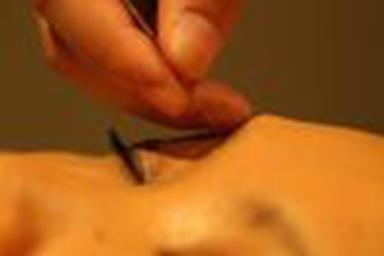 美容鍼と小顔マッサージ60分