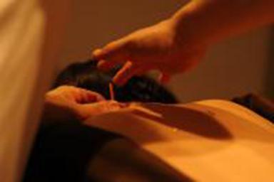 90分コース（鍼のみ）