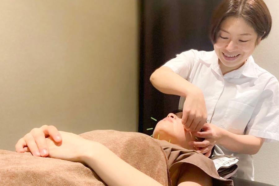 美容鍼30分コース